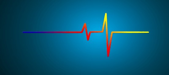Phono vs line signal